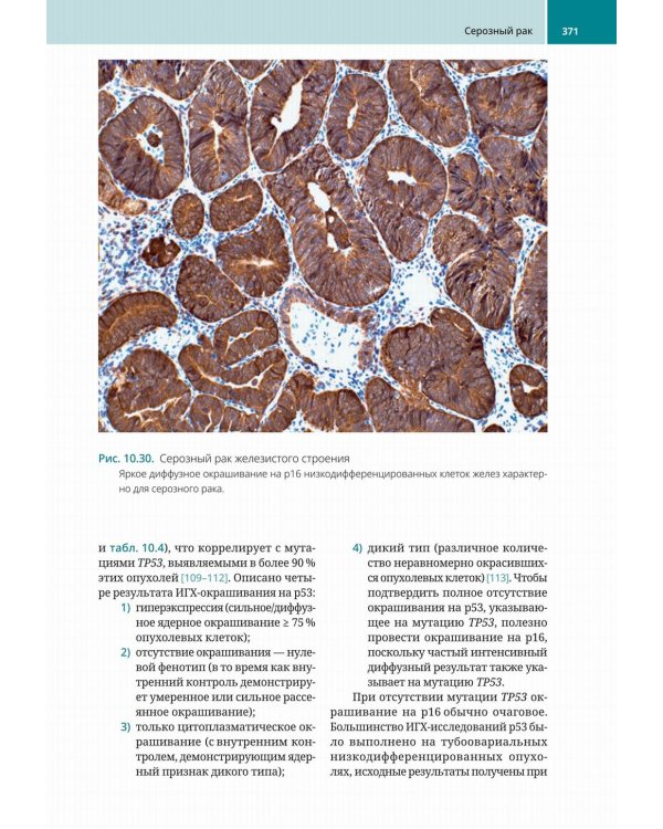 Биопсии эндометрия. Практическое руководство