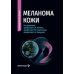 Меланома кожи: руководство для врачей
