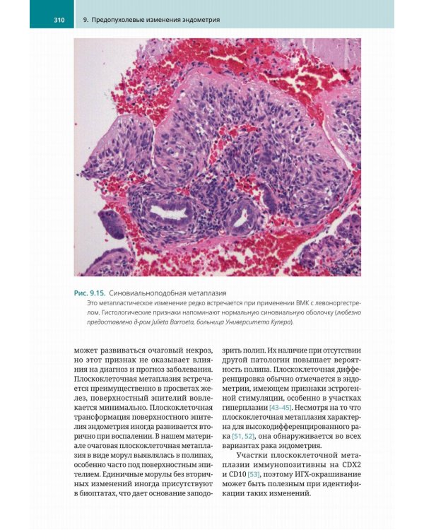 Биопсии эндометрия. Практическое руководство