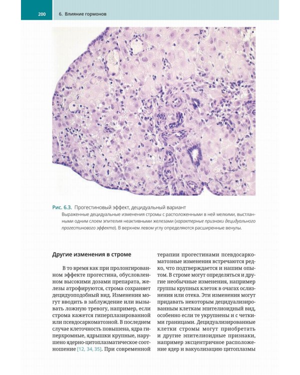 Биопсии эндометрия. Практическое руководство