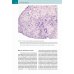 Биопсии эндометрия. Практическое руководство