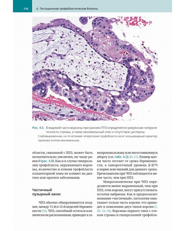Биопсии эндометрия. Практическое руководство