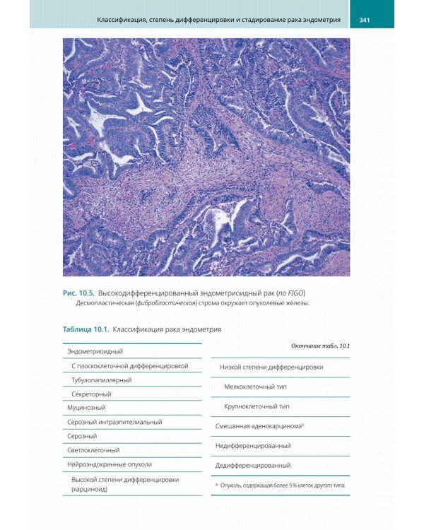 Биопсии эндометрия. Практическое руководство
