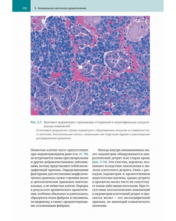 Биопсии эндометрия. Практическое руководство