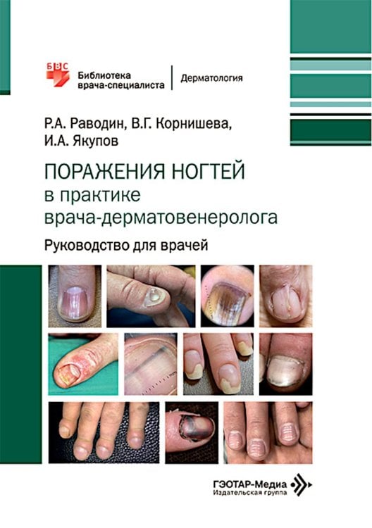Обложка книги «Поражения ногтей в практике врача-дерматовенеролога: руководство для врачей» — Корнишева Вера Гавриловна;Раводин Роман Анатольевич;Якупов Ильяс Абдуллович, ISBN 9785970472385
