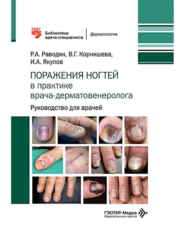 Дополнительное изображение книги «Поражения ногтей в практике врача-дерматовенеролога: руководство для врачей»