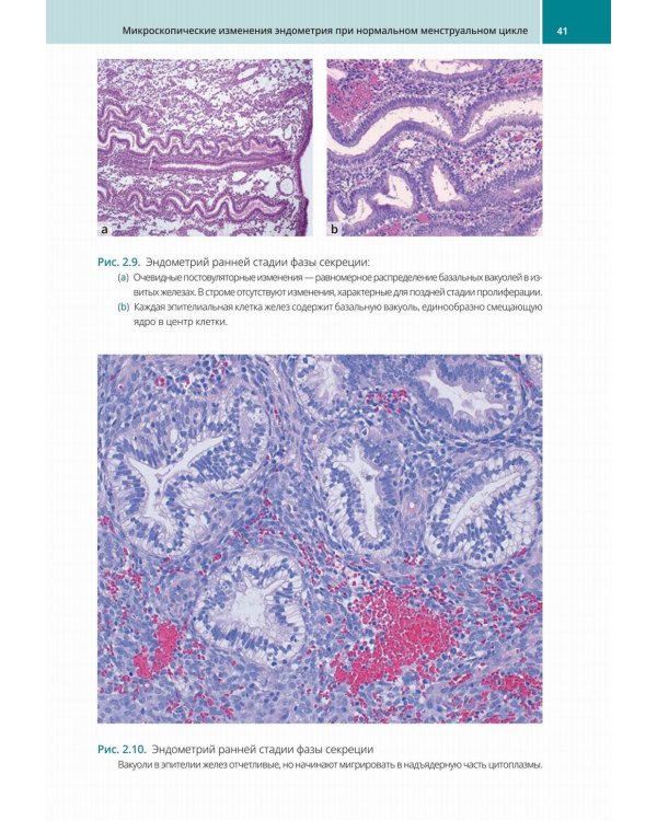 Биопсии эндометрия. Практическое руководство