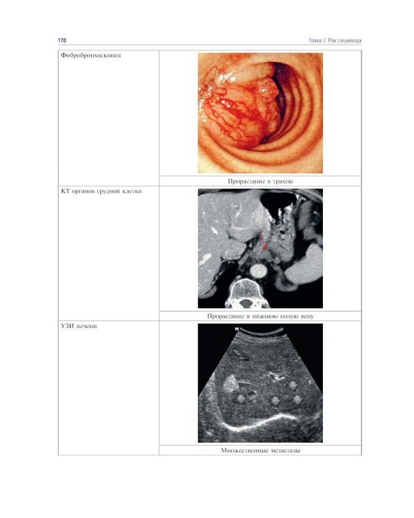 Курс онкологии в рисунках, таблицах и схемах: учебное пособие