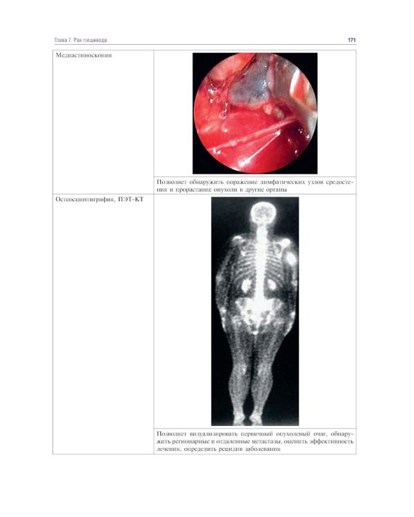 Курс онкологии в рисунках, таблицах и схемах: учебное пособие