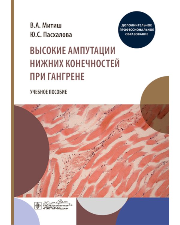 Высокие ампутации нижних конечностей при гангрене: Учебное пособие