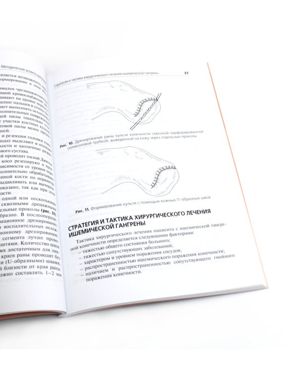 Высокие ампутации нижних конечностей при гангрене: Учебное пособие