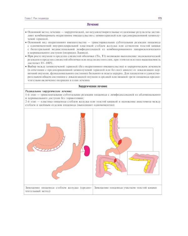 Курс онкологии в рисунках, таблицах и схемах: учебное пособие