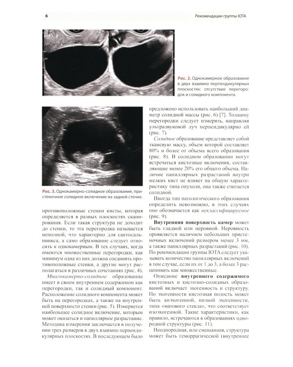 Стандартизация ультразвукового исследования патологии придатков матки по IOTA, O-RADS. Методические рекомендации. 3-е изд., доп