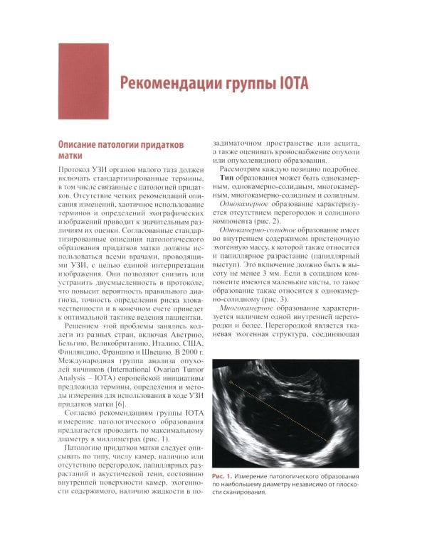 Стандартизация ультразвукового исследования патологии придатков матки по IOTA, O-RADS. Методические рекомендации. 3-е изд., доп