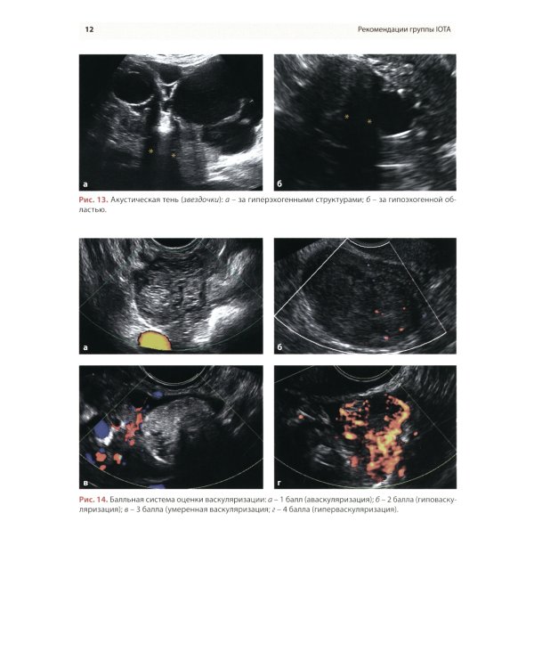 Стандартизация ультразвукового исследования патологии придатков матки по IOTA, O-RADS. Методические рекомендации. 3-е изд., доп