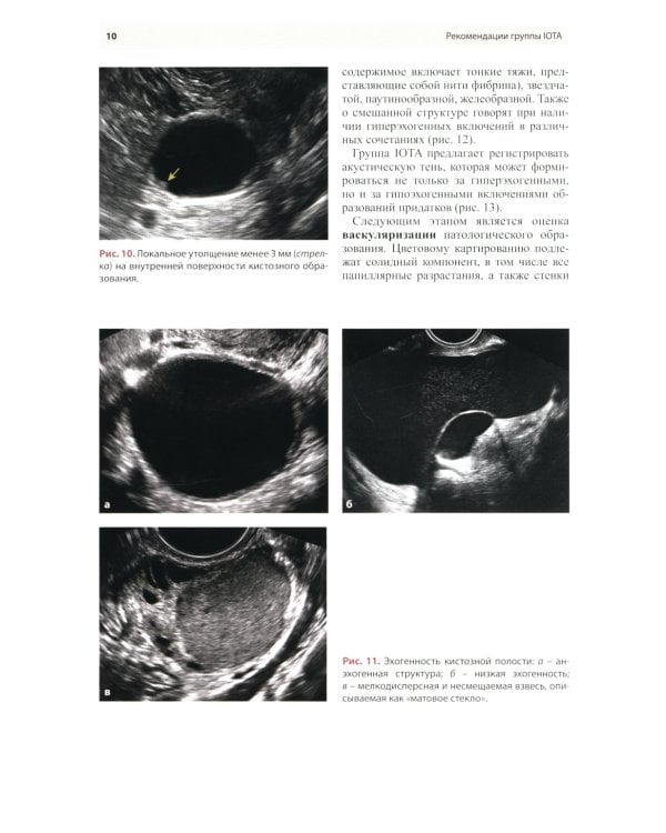 Стандартизация ультразвукового исследования патологии придатков матки по IOTA, O-RADS. Методические рекомендации. 3-е изд., доп