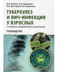 Туберкулез и ВИЧ-инфекция у взрослых. Руководство. 2-е изд., перераб. и доп