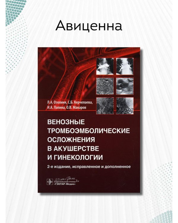 Венозные тромбоэмболические осложнения в акушерстве
