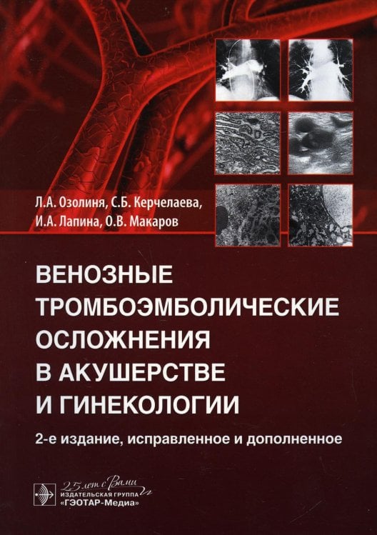 Венозные тромбоэмболические осложнения в акушерстве и гинекологии. 2-е изд., испр. и доп Венозные тромбоэмболические осложнения в акушерстве и гинекологии. 2-е изд., испр. и доп