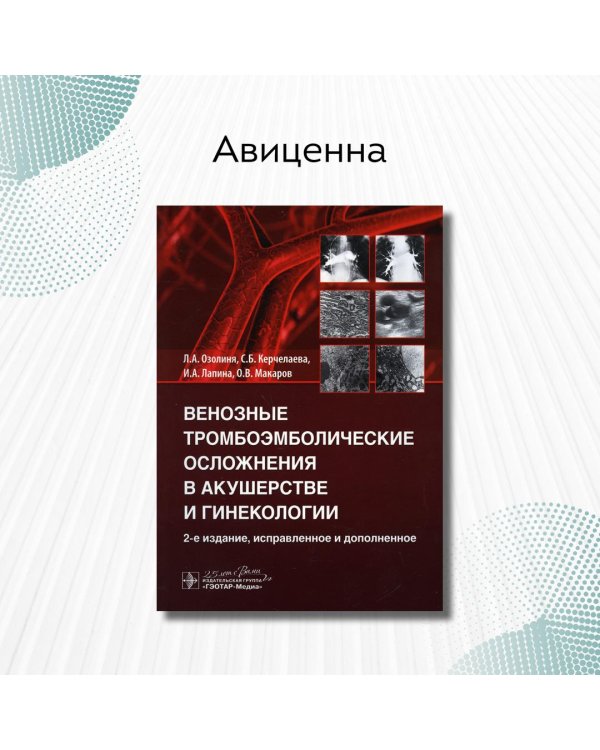Венозные тромбоэмболические осложнения в акушерстве