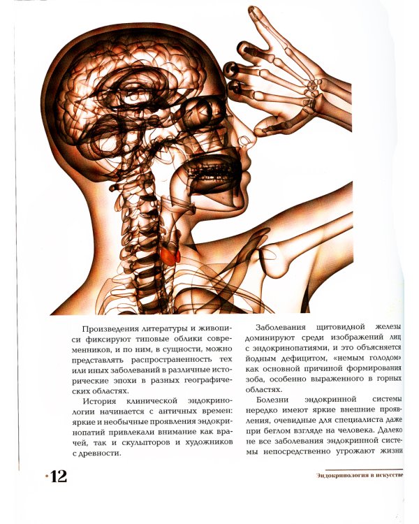 Эндокринология в искусстве