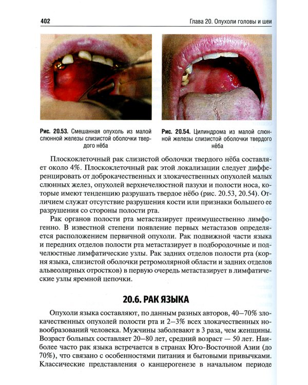 Онкология: Учебник. 2-е изд., испр. и доп