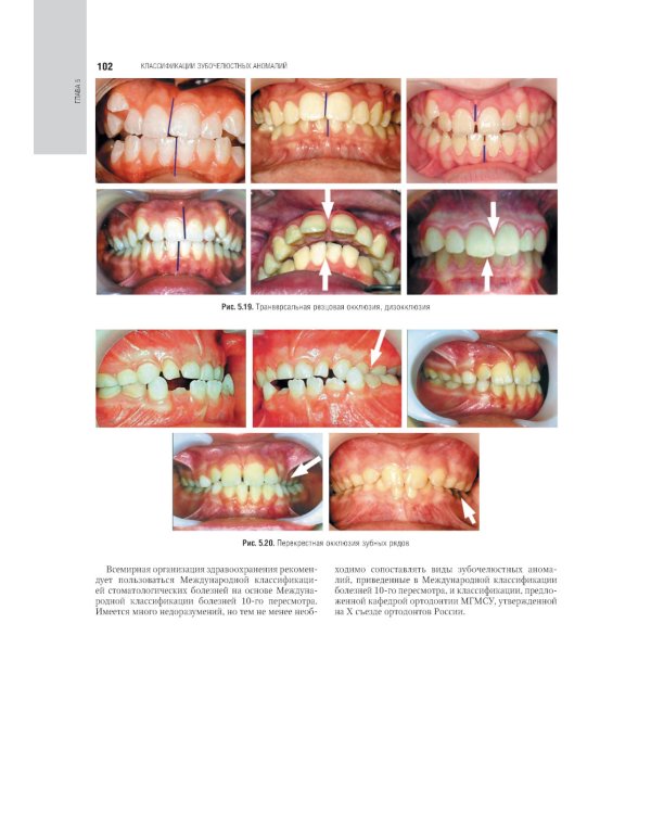 Ортодонтия. Национальное руководство. В 2 т. Т. 1. Диагностика зубочелюстных аномалий