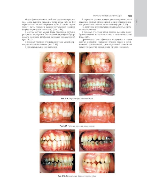 Ортодонтия. Национальное руководство. В 2 т. Т. 1. Диагностика зубочелюстных аномалий