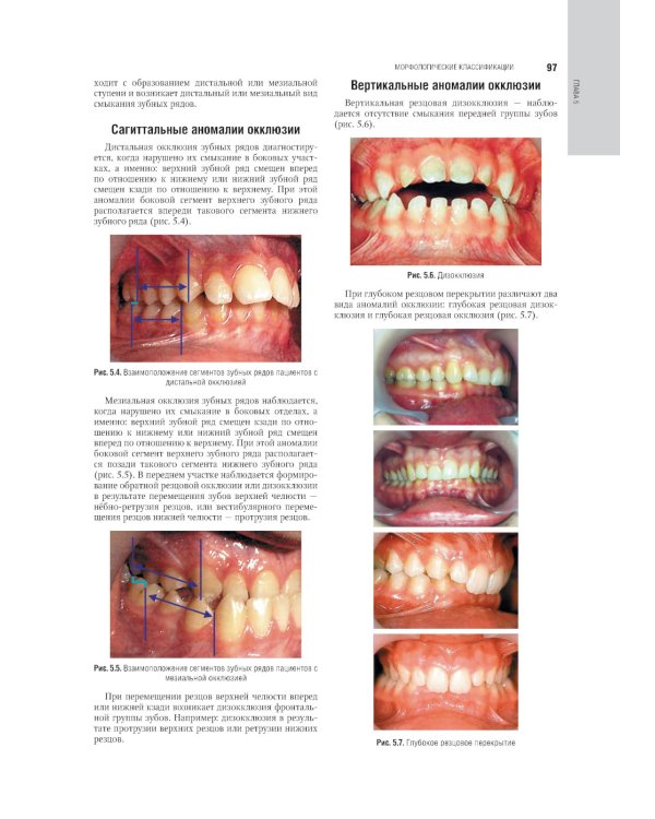 Ортодонтия. Национальное руководство. В 2 т. Т. 1. Диагностика зубочелюстных аномалий