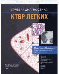 Лучевая диагностика. КТВР легких