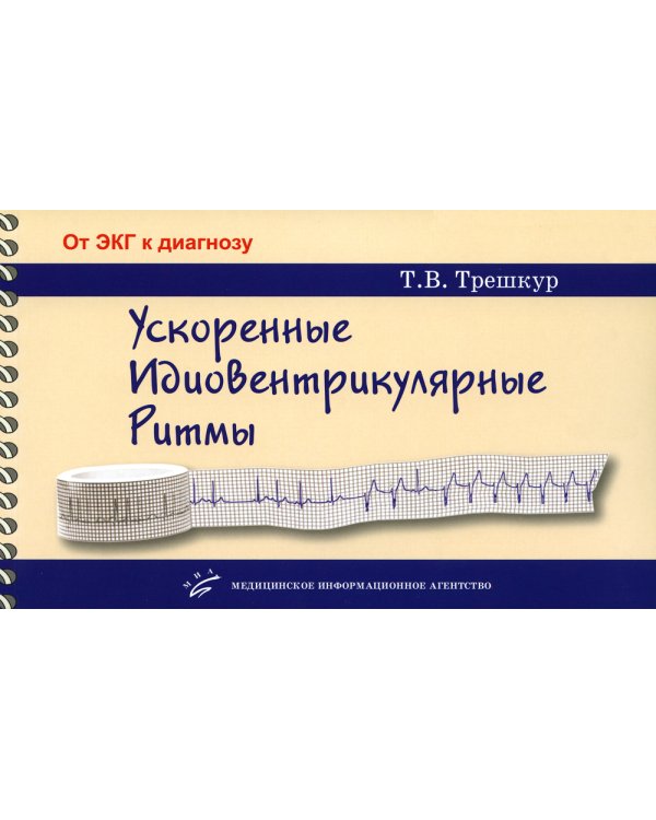 Ускоренные идиовентрикулярные ритмы: клинико-электрокардиографические особенности, систематизация по ЭКГ-характеристикам, дифференцирование с другими
