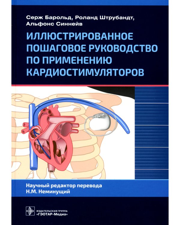 Иллюстрированное пошаговое руководство по применению кардиостимуляторов