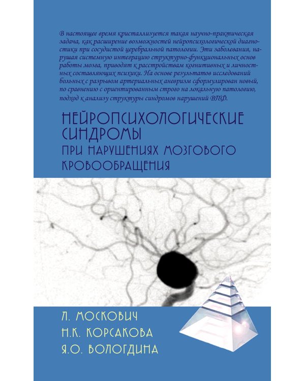 Нейропсихологические синдромы при нарушениях мозгового кровообращения