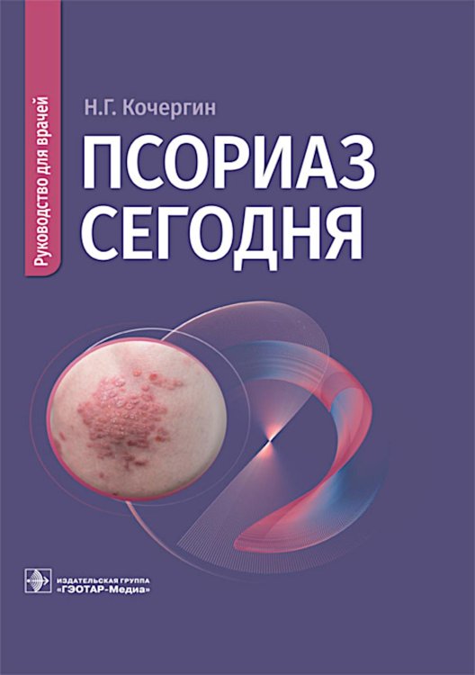 Псориаз сегодня: руководство для врачей Псориаз сегодня: руководство для врачей