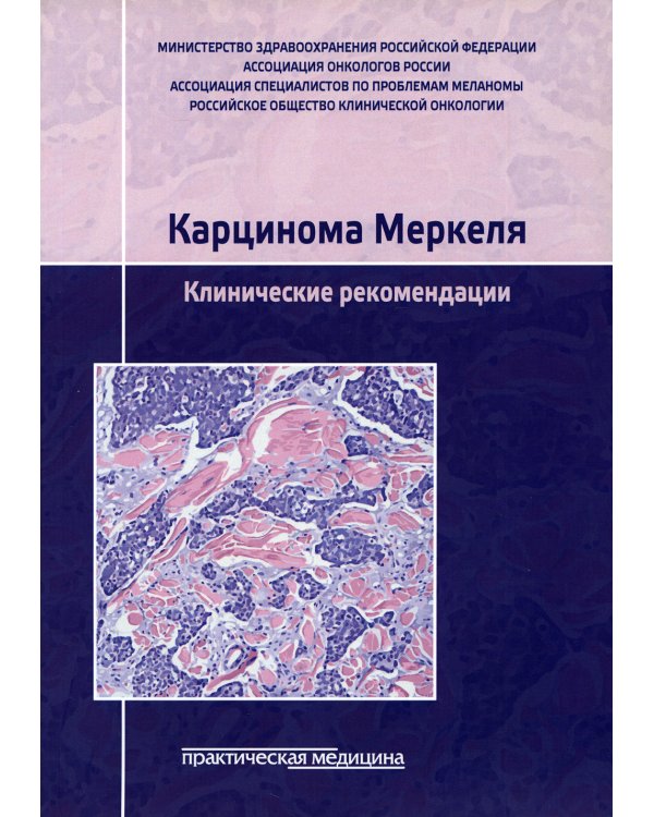 Карцинома Меркеля. Клинические рекомендации