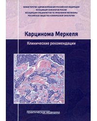 Карцинома Меркеля. Клинические рекомендации