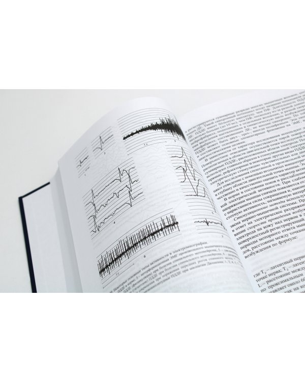 Болезни нервной системы: руководство для врачей. В 2 т. (комплект из 2-х книг). 7-е изд., репринт