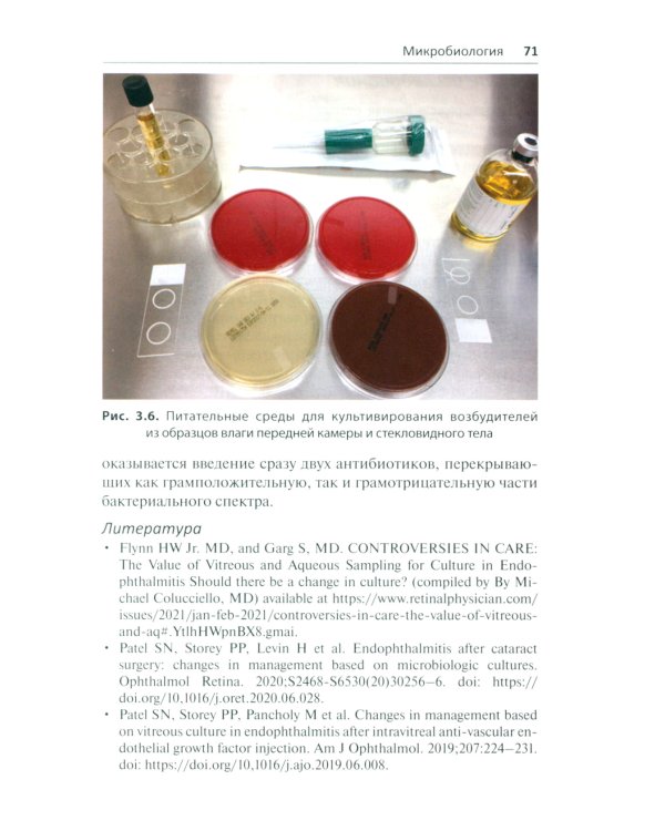 Эндофтальмит в клинической практике