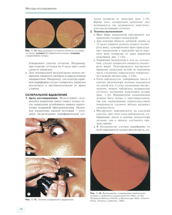 Заболевания глазного дна. 3-е изд