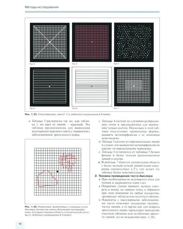 Заболевания глазного дна. 3-е изд