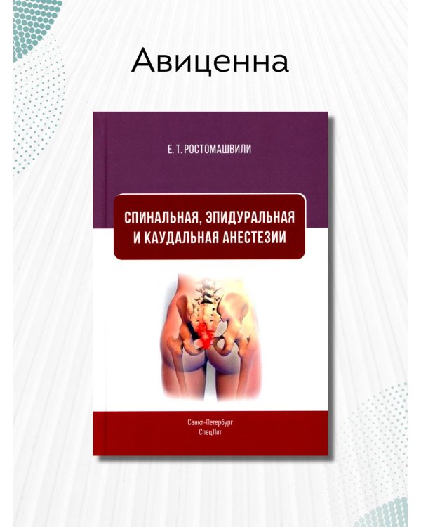 Спинальная, эпидуральная и каудальная анестезии