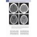 Судебно-медицинская радиология. От идентификации личности до посмертной визуализации