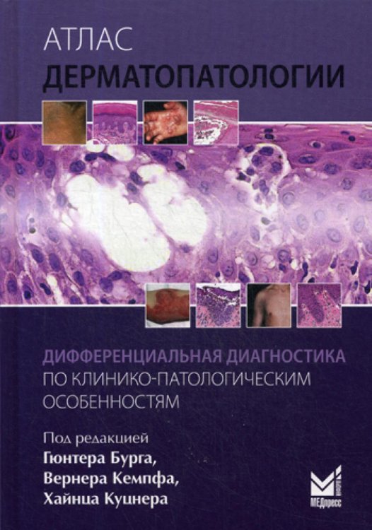 Атлас дерматопатологии: Дифференциальная диагностика по клинико-патологическим особенностям
