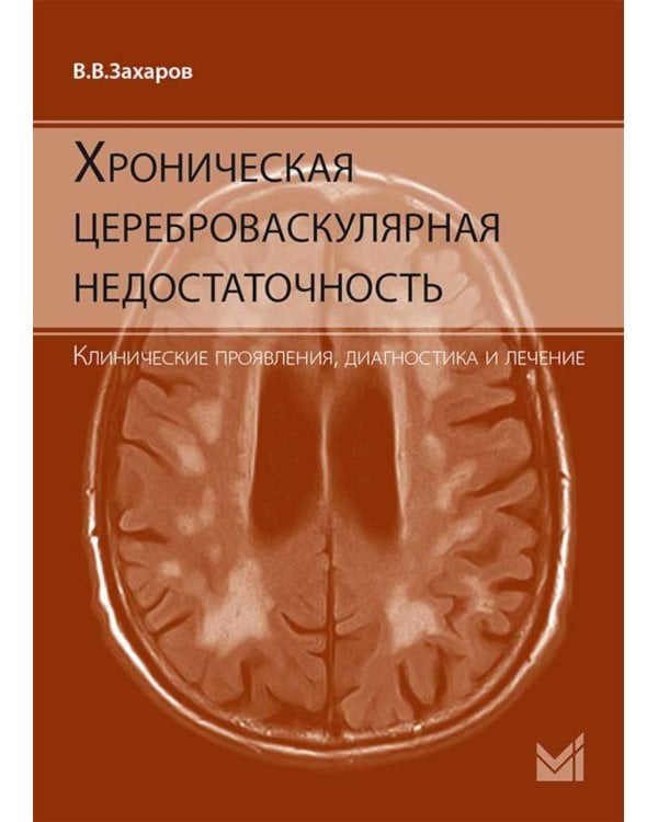 Хроническая цереброваскулярная недостаточность. 4-е изд., перераб.и доп