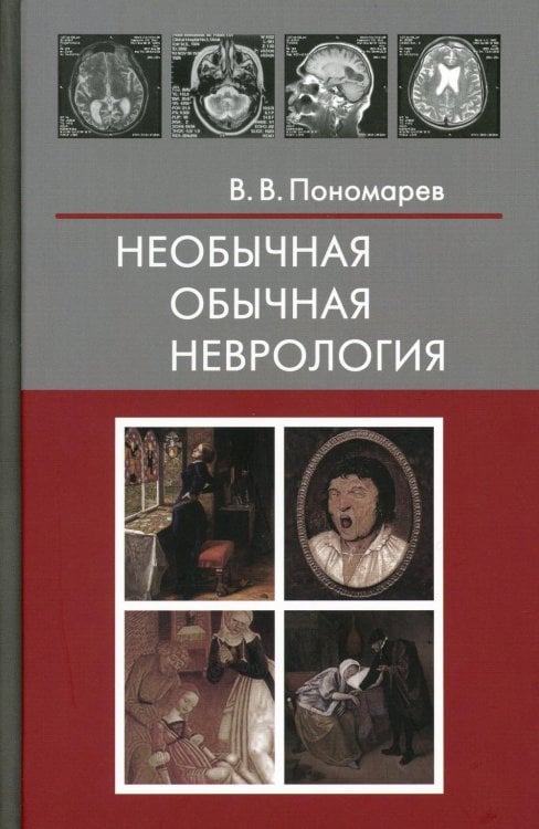 Необычная обычная неврология: руководство для врачей Необычная обычная неврология: руководство для врачей