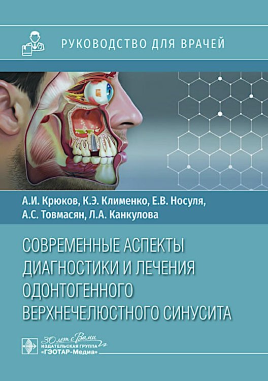 Современные аспекты диагностики и лечения одонтогенного верхнечелюстного синусита: руководство для врачей