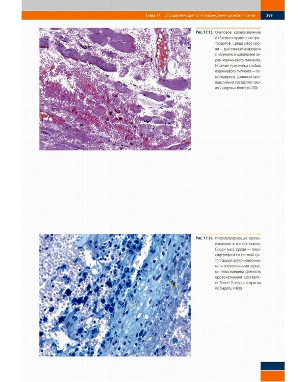 Судебно-медицинская гистология: иллюстрированный алгоритм судебно-гистологического исследования