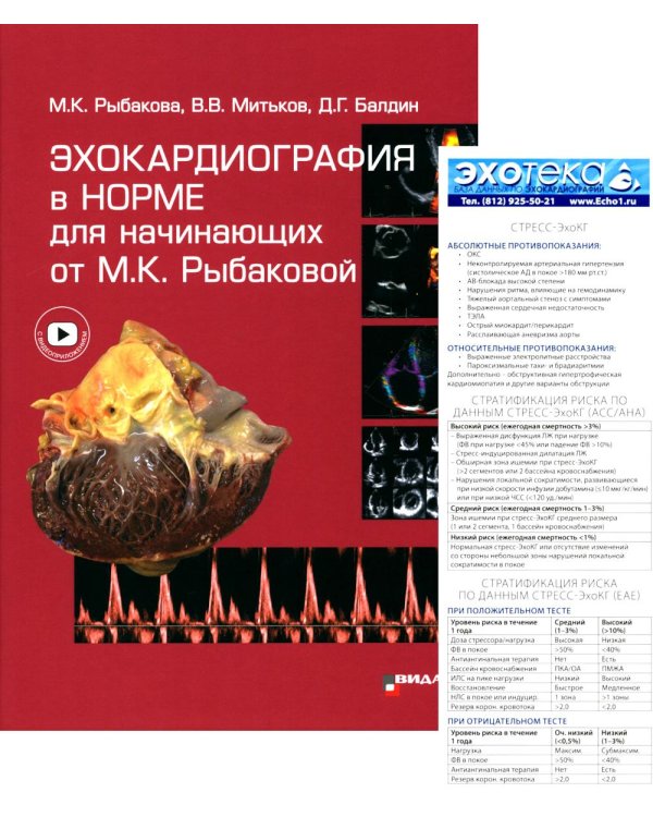 Пособие по эхокардиографии (Буклет Эхотека); Эхокардиография в норме для начинающих от М.К. Рыбаковой (комплект из 2-х книг)