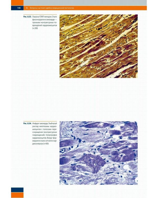 Судебно-медицинская гистология: иллюстрированный алгоритм судебно-гистологического исследования