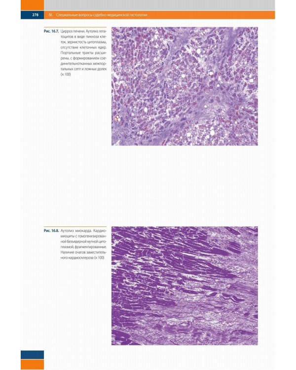 Судебно-медицинская гистология: иллюстрированный алгоритм судебно-гистологического исследования